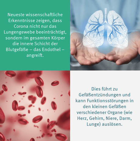 Quercetin_Instagram-2404_Bild-2