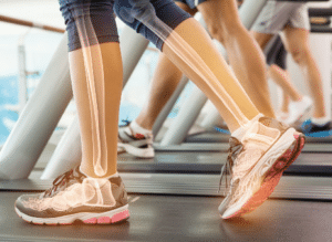 Position der Knochen und Gelenge beim Fitnesstraining auf einem Laufband